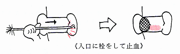 耳鼻科の急病画像